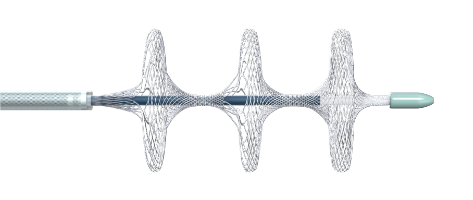國(guó)內(nèi)首創(chuàng)!本市研發(fā)生產(chǎn)的1款Ⅲ類創(chuàng)新醫(yī)療器械獲批上市,為具有溶栓禁忌癥的患者提供了治療選擇 國(guó)內(nèi)首創(chuàng)!本市研發(fā)生產(chǎn)的1款Ⅲ類創(chuàng)新醫(yī)療器械獲批上市,為具有溶栓禁忌癥的患者提供了治療選擇